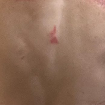 Nirvana Day Spa - Unexplained mark on my spine which appears to be a "JA" and feels like a burn - Day Spas Near Me - Thousand Oaks, California