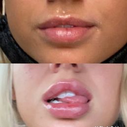 Before vs after Before vs after