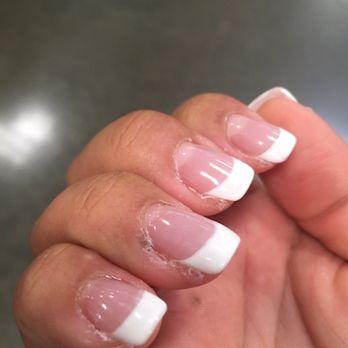 Oasis Nails - Glue left on the finger and my nail beds look HORRID - Nail Salons Near Me - Kapolei, Hawaii Oasis Nails - Glue left on the finger and my nail beds look HORRID - Nail Salons Near Me - Kapolei, Hawaii