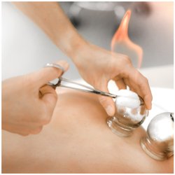 Scarsdale Acupuncture - Glass fire cups