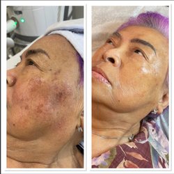 Lux Laser Medspa