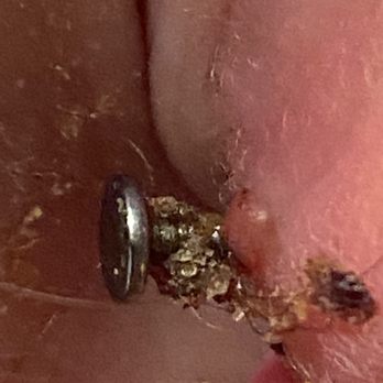 Piercing Vegas - This is how I woke up 3 days ago. The piercing Travis did. Third lobe hole - Piercing Near Me - Las Vegas, Nevada