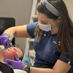 Valley Medspa - Microneedling in action