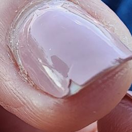 Started to chip after 4 days! Shelak manicure Started to chip after 4 days! Shelak manicure