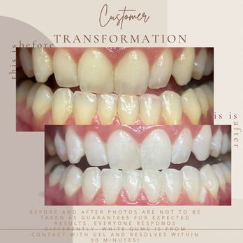 Enchanted Smiles - Teeth Whitening Near Me - Dover, New Hampshire Enchanted Smiles - Teeth Whitening Near Me - Dover, New Hampshire