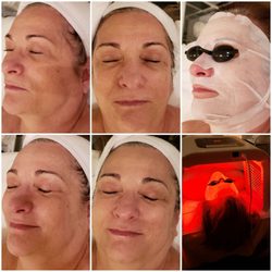 Crystal Pure Skin Care - Bdr acid peeling /special anti aging massage / bed stretch lift mask !!!