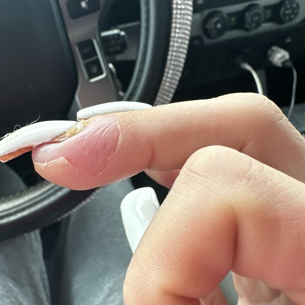 Nail place gone wrong Nail place gone wrong