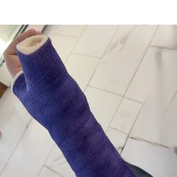 Hand Microsurgery & Reconstruction Orthopaedics - The first incorrect cast