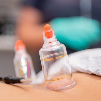 Florida Complete Wellness - Acupuncture Near Me - Hialeah Gardens, Florida
