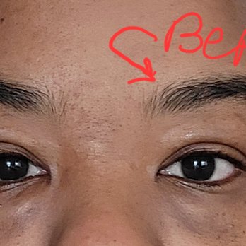 Dawa Threading Salon - Another before photo not bald spot - Threading Services Near Me - Astoria, New York Dawa Threading Salon - Another before photo not bald spot - Threading Services Near Me - Astoria, New York
