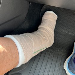 EmergeOrtho - Repair of left Achilles Tendon
