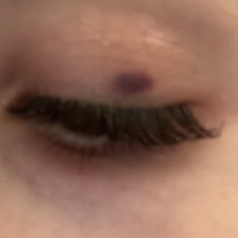 MaxiLash Boutique - Close-up image of a closed eye with eyelash extensions, showing a small blemish above the eyelid, in a neutral setting. - Eyelash Service Near Me - Boston, Massachusetts