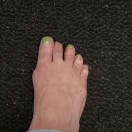 Green toes two weeks old.