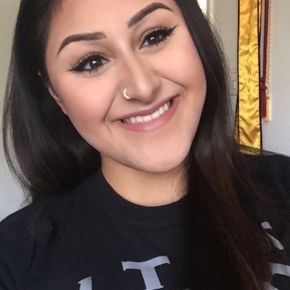 before braces