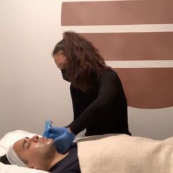 Shen+Tonic - Micro-needling