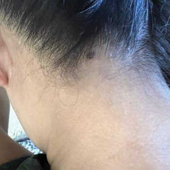 YUME Hair - Found another big burn today. Have a few all over but small, this one is pretty large. - Hair Stylists Near Me - New York, New York
