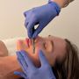 Photo of EBSKIN