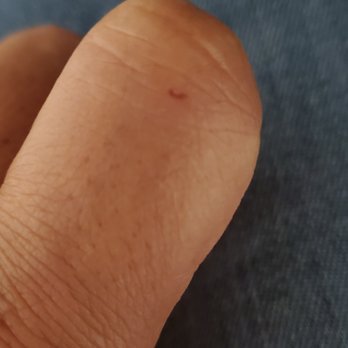 AP Nails - Cut me in my finger - Nail Salons Near Me - Long Beach, California