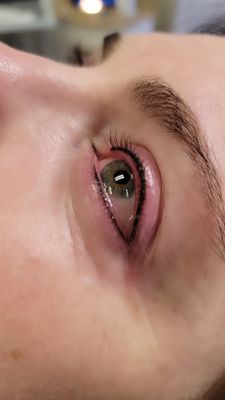 tirzepatide source Tirzepatide diabetes drug injection | Stock Image tirzepatide source Tirzepatide diabetes drug injection | Stock Image