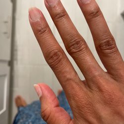NAILS 4 YOU - Dry, rough, scratched up nails after gel removal.