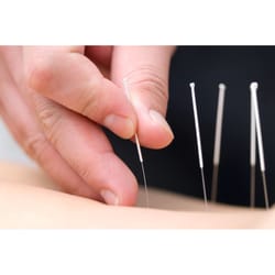 NYOH Acupuncture Clinic