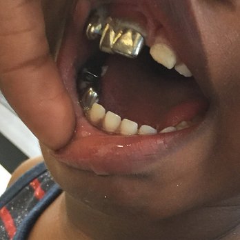 A Smile Above - Pediatric Dentists Near Me - Arlington, Texas