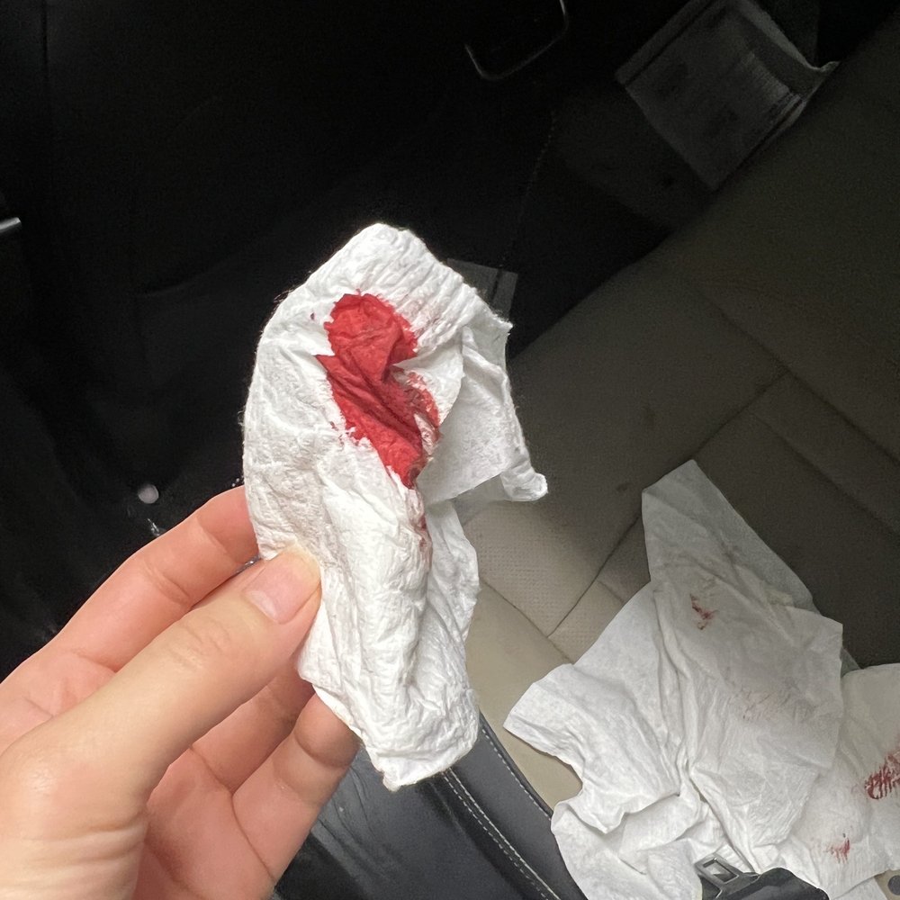 Pampered Paws - Blood on the papertowels they gave us - Pet Groomers Near Me - Wasilla, Alaska Pampered Paws - Blood on the papertowels they gave us - Pet Groomers Near Me - Wasilla, Alaska