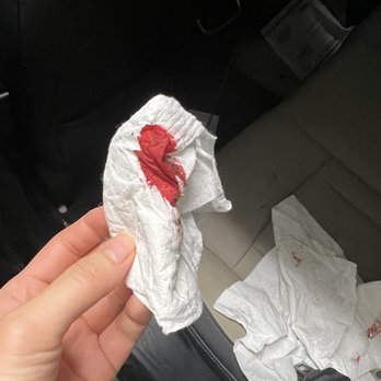 Pampered Paws - Blood on the papertowels they gave us - Pet Groomers Near Me - Wasilla, Alaska