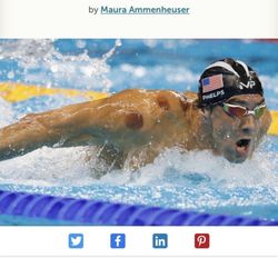 Relax Spa - Cupping explained in Article