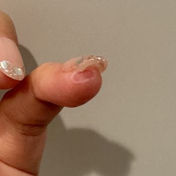 Maison Nail Spa - After a few days. Still hurting and had a heartbeat. - Nail Salons Near Me - Pasadena, California Maison Nail Spa - After a few days. Still hurting and had a heartbeat. - Nail Salons Near Me - Pasadena, California