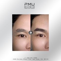 PMU Clinic