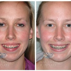 Virginia Advanced Surgical Arts - Jaw surgery
