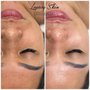 Photo of Luxury Skin