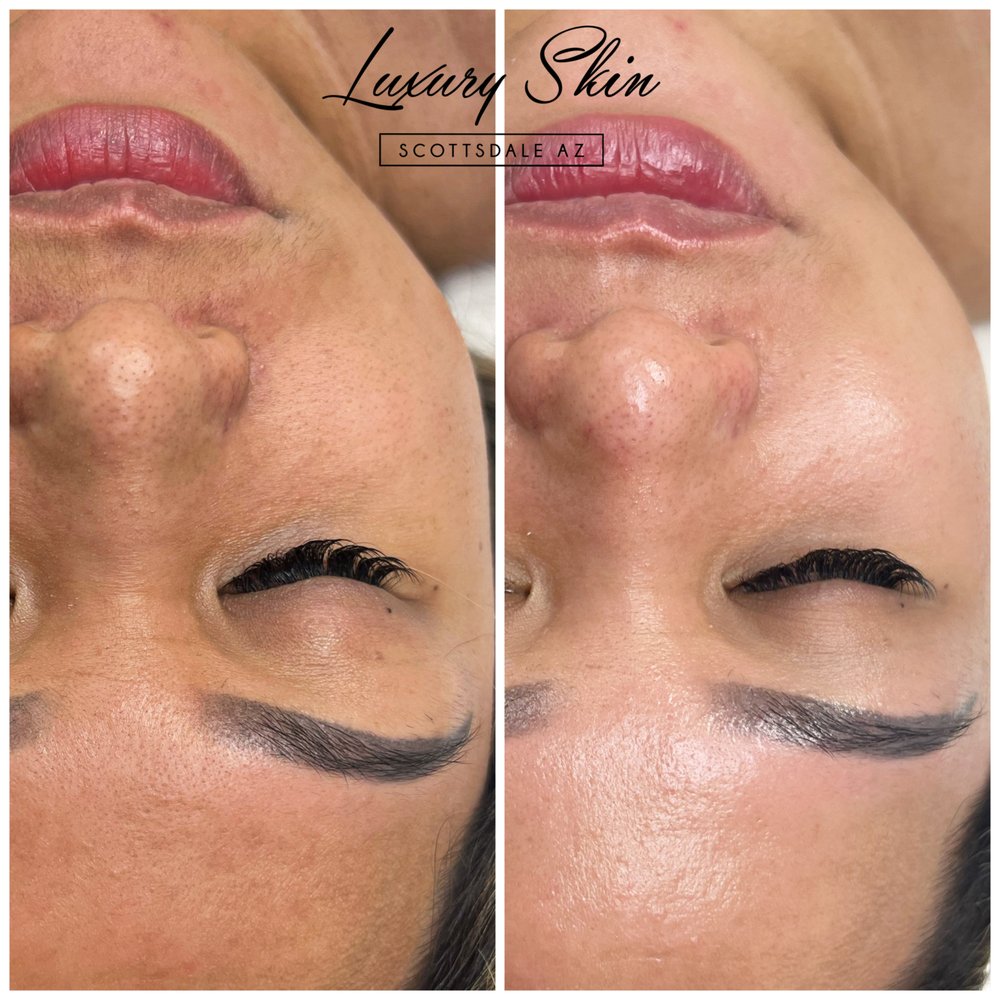 Luxury Skin Logo