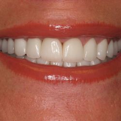 David Engelsberg, DDS - SMILE MAKEOVER