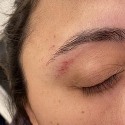 Both my botched eyebrows