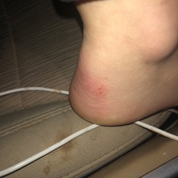 Divine Nail Spa - My horrible cuts from divine nail spa - Nail Salons Near Me - Niagara Falls, New York