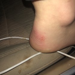 Divine Nail Spa - My horrible cuts from divine nail spa