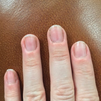 Fine Nails - My dirty, unevenly shaped, deeply scratched nails, still showing residual gel mani. - Nail Salons Near Me - Atlanta, Georgia
