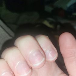 My nails after the owner ripped my acrylics off