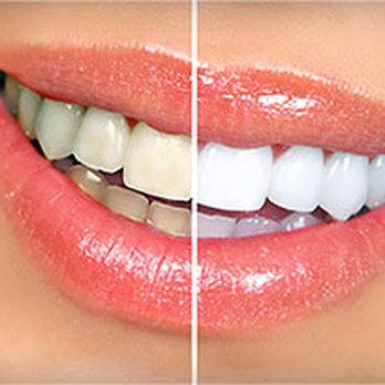 Hemet Smile Specialist: Scott D. Gray, DDS - General Dentistry Near Me - Hemet, California Hemet Smile Specialist: Scott D. Gray, DDS - General Dentistry Near Me - Hemet, California