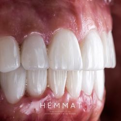 HÉMMAT BIO-AESTHETICS - Veneer's Zahnmedizin am Kudamm