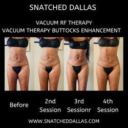 Vacuum Therapy