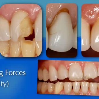 Pacific Ocean Dental Group - Cosmetic Dentists Near Me - Los Angeles, California Pacific Ocean Dental Group - Cosmetic Dentists Near Me - Los Angeles, California