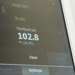 Dignity Health Arizona General Hospital - Mesa - My discharge temp that I had to ask for because they did not do a discharge set of vitals even though it says they did on the paperwork