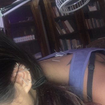 Elements Natural Therapy - Acupuncture Near Me - Phoenix, Arizona