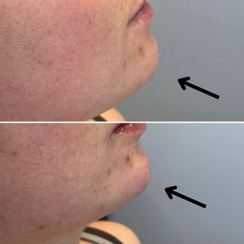 Envy Injectables & Skincare - Medical Spas Near Me - Westminster, Colorado Envy Injectables & Skincare - Medical Spas Near Me - Westminster, Colorado