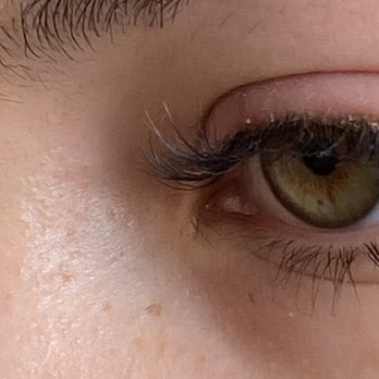 Deka Lash - Photo taken less than 48h after initial fill. Many lashes missing and thick crust along lash line. - Eyelash Service Near Me - Denver, Colorado Deka Lash - Photo taken less than 48h after initial fill. Many lashes missing and thick crust along lash line. - Eyelash Service Near Me - Denver, Colorado