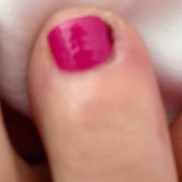 Bloody toe : ( Bloody toe : (