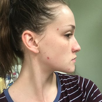 Nu Essence Spa - Facial disaster - Day Spas Near Me - Springfield, Missouri